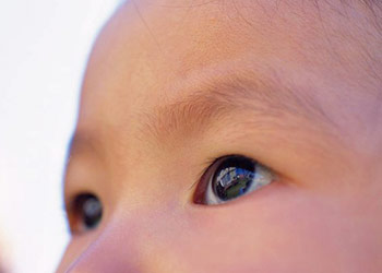Watery Eye Baby Causes and Treatment