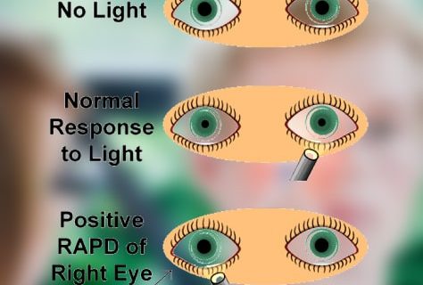 Eye See What You Did There: A Pupil’s Response to Light