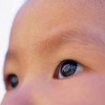 Watery Eye Baby: Causes and Treatment